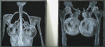 Female and Male terrorist captured on X - ray